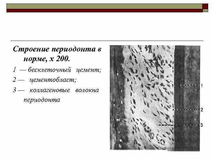 Строение периодонта волокна. Коллагеновые волокна периодонта. Зубоальвеолярные волокна периодонта. Строение периодонта зуба волокна. Коллагеновые волокна периодонта.