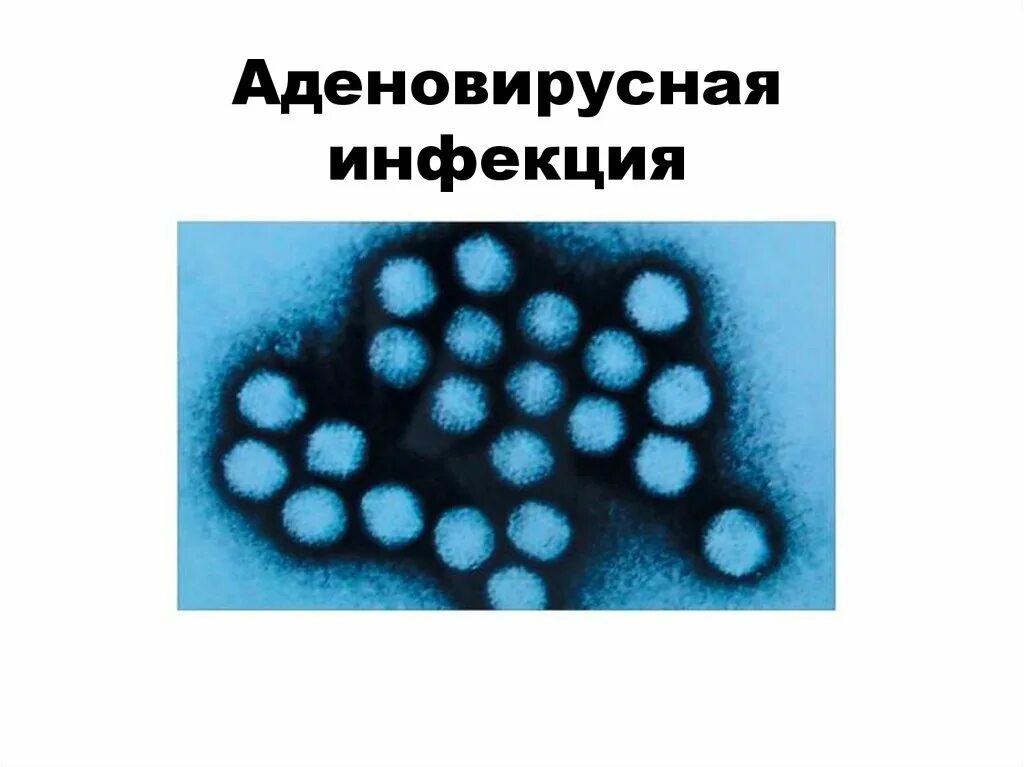 Аденовирусная инфекция. Клинические проявления аденовируса. Аденовирусная инфекция заражение. Аденовирус источник инфекции. Аденовирус гриппа