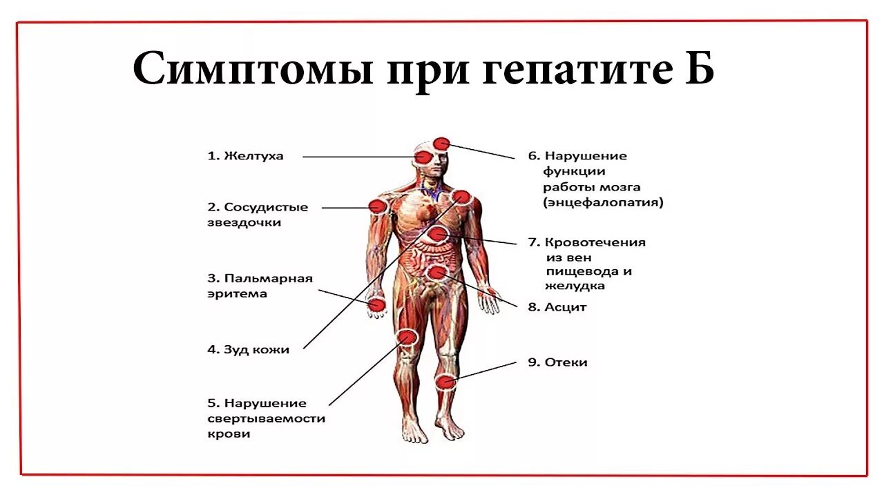 Признаки гепатита а у женщин. Гепатит симптомы у мужчин. Гепатит симптомы у мужчин первые.