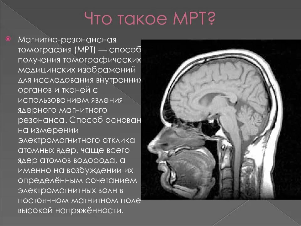Как описывается мрт. 2. магнитно-резонансная томография (мрт). магнитно-резонансная томография (мрт) презентация. метод магнитно-резонансной томографии (мрт). мрт исследование презентация.