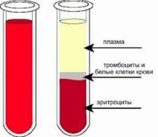 Плазма это кровь. Отделение эритроцитов от плазмы крови. Как выглядит плазма крови. Состав крови в пробирке.