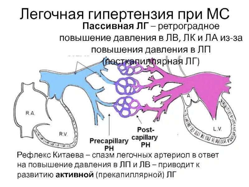 Легочная гипертензия 1. Легочная гипертензия 1
