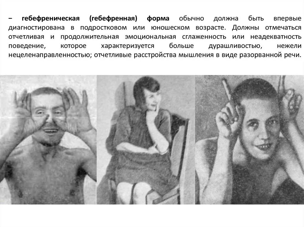Шизофрения признаки у женщин фото. Гебефренический синдром симптомы. гебефреническая шизофрения синдромы. гебефреническая шизофрения характеристика. гебефреническая форма шизофрении. клиника, течение.