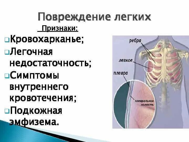 Симптомы легкого течения. Травма легкого симптомы. Повреждения грудной клетки.