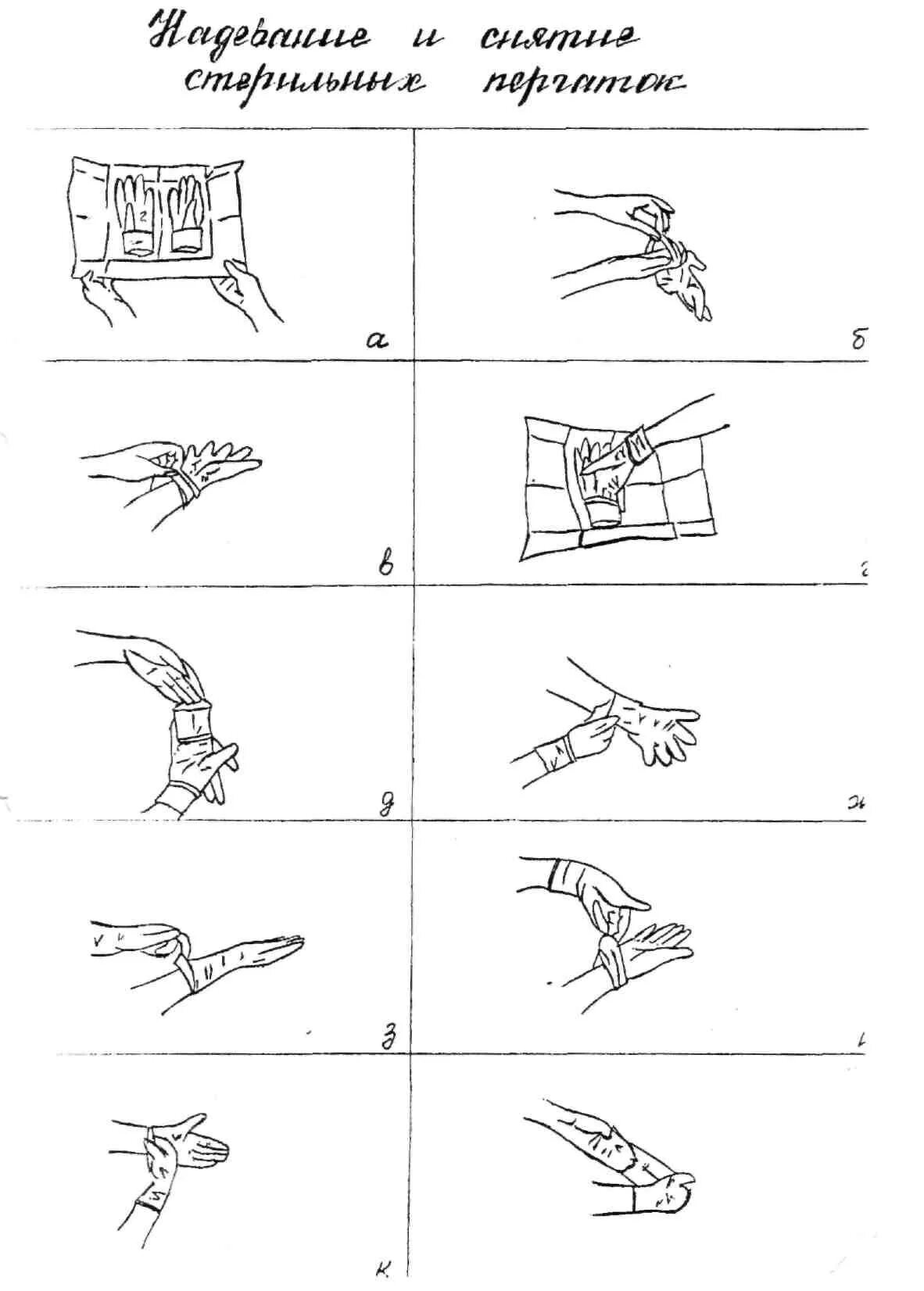 Перчатка алгоритм. Надевание стерильных перчаток. Техника надевания стерильных перчаток. Надевание и снимание стерильных перчаток. Схема снятия стерильных перчаток.