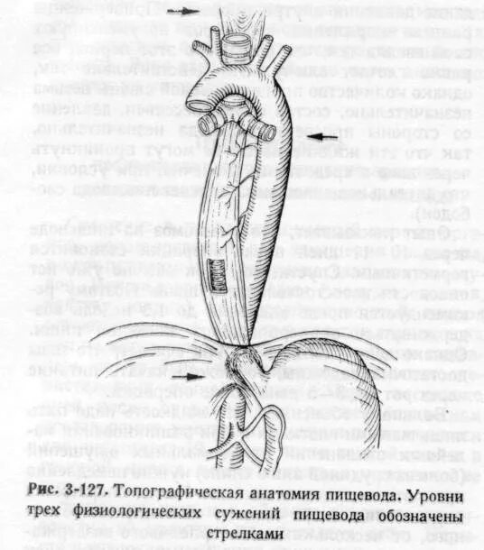 Уровни сужения пищевода