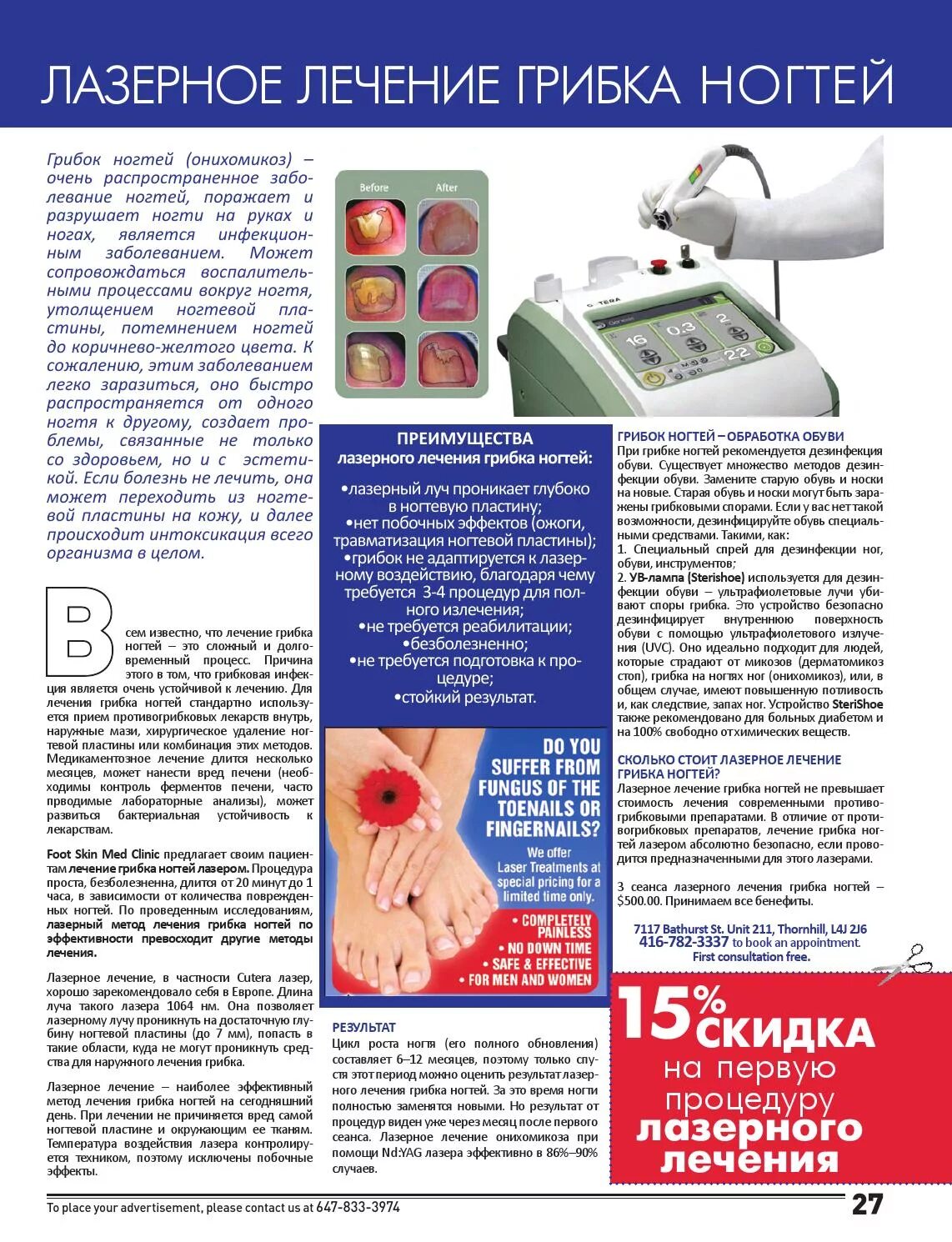 Лечение грибка на ногах лазером отзывы. Лазер для обработки грибка. лазерное лечение грибка. местная терапия микозов.