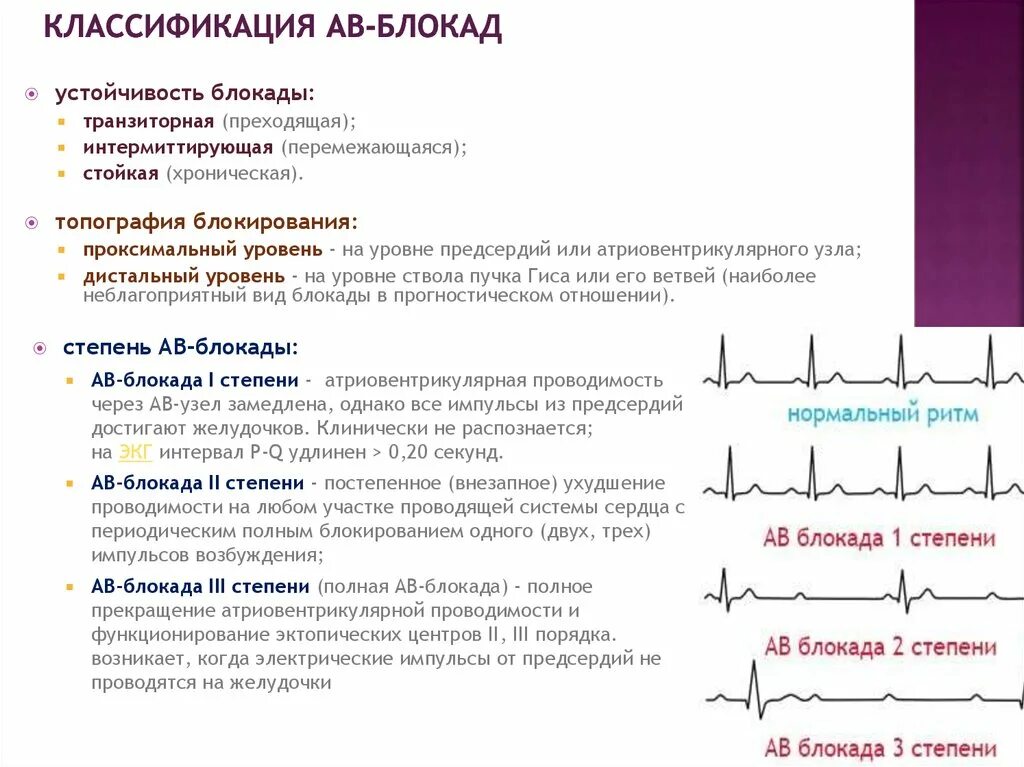 Признаки атриовентрикулярной блокады III степени. Атриовентрикулярная блокада 2 степени классификация. АВ блокада 1 степени классификация. АВ блокада 2 степени классификация.