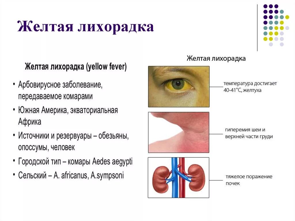 Желтая лихорадка клиника. Желтая лихорадка источники инфекции. Желтая лихорадка способы передачи. Симптомы желтой лихорадки кратко. Наиболее характерные симптомы желтой лихорадки.