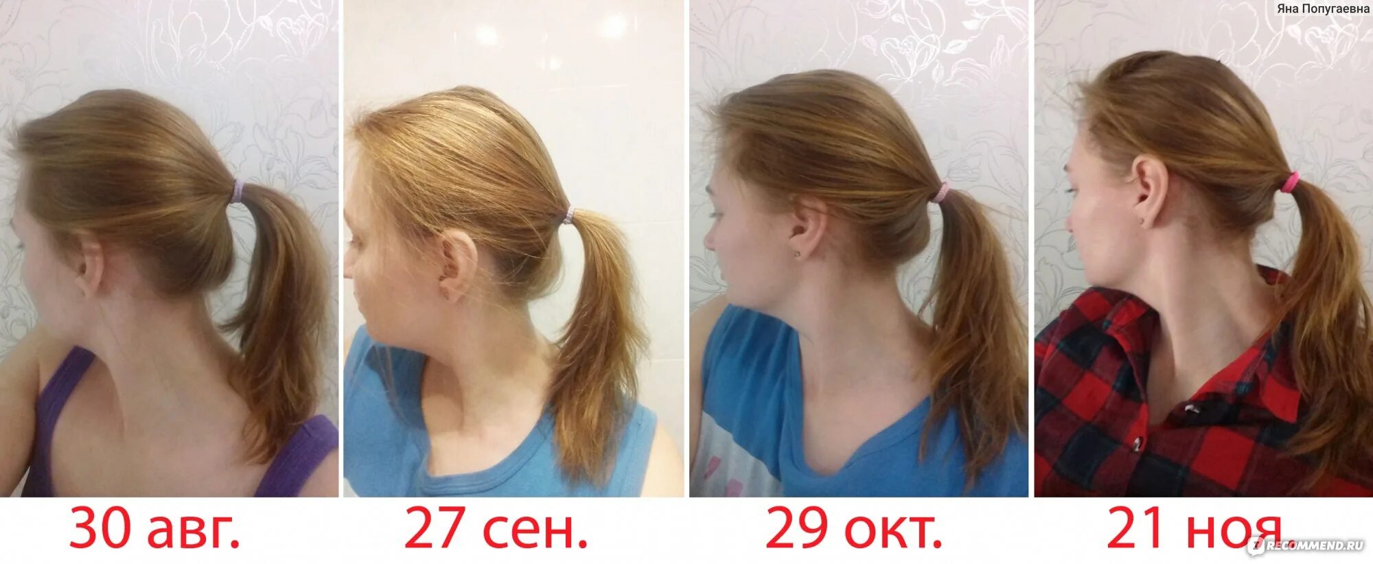 Плазмолифтинг для волос- описание процедуры, фото до и после