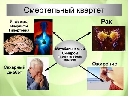 Гипертонический инсульт