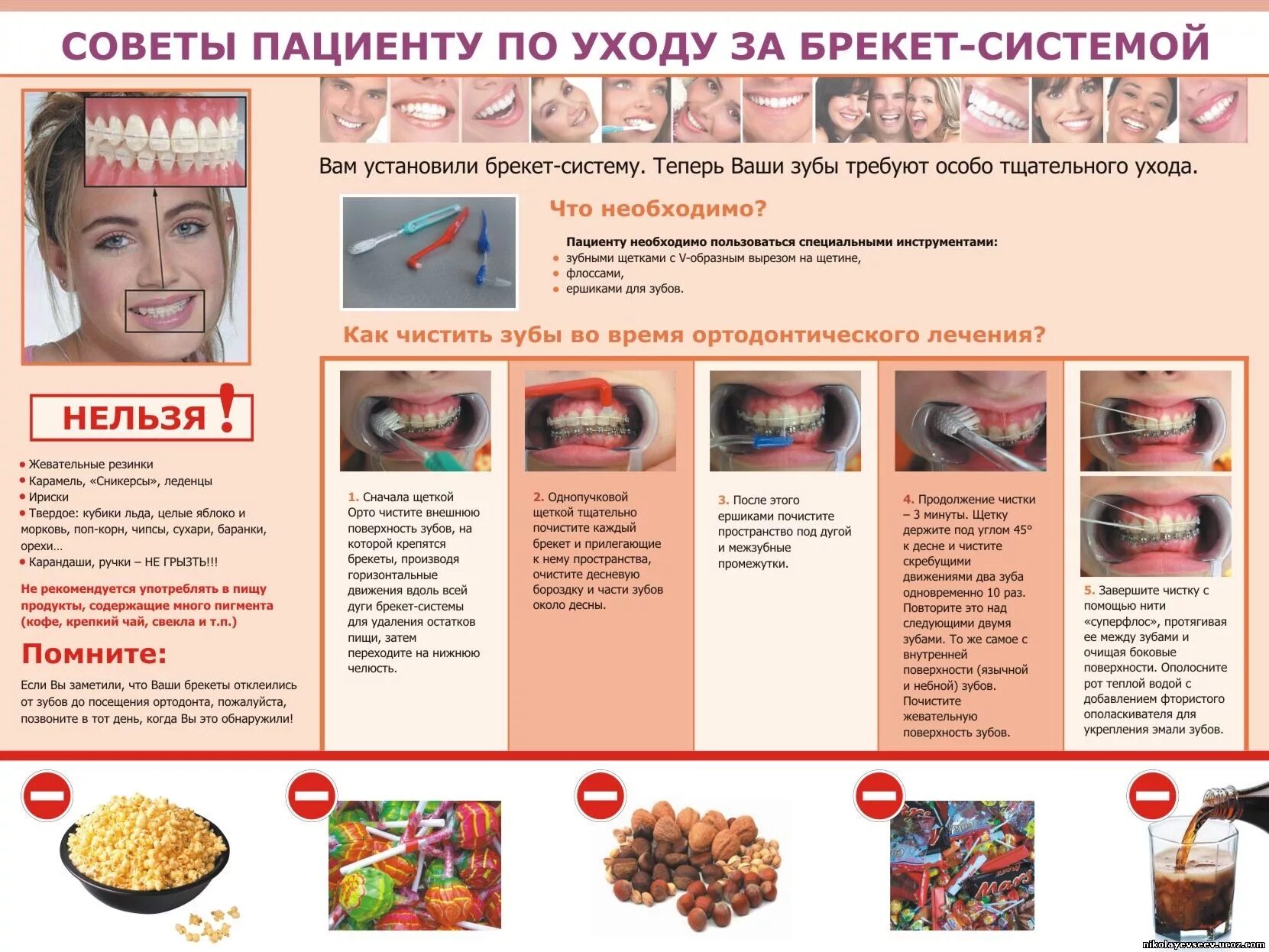 Чего нельзя есть рот. Питание после установки брекетов меню. чтон ельщзя есть с брекетами. ччнельзя а сть с брекетами. что нельзя есть при брекетах.