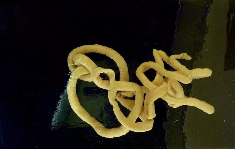 Ленточные черви бычий цепень. Ленточные черви широкий лентец. Аскарида, трихинелла, острица, власоглав. Длинные паразиты человека. Длинные паразиты человека.