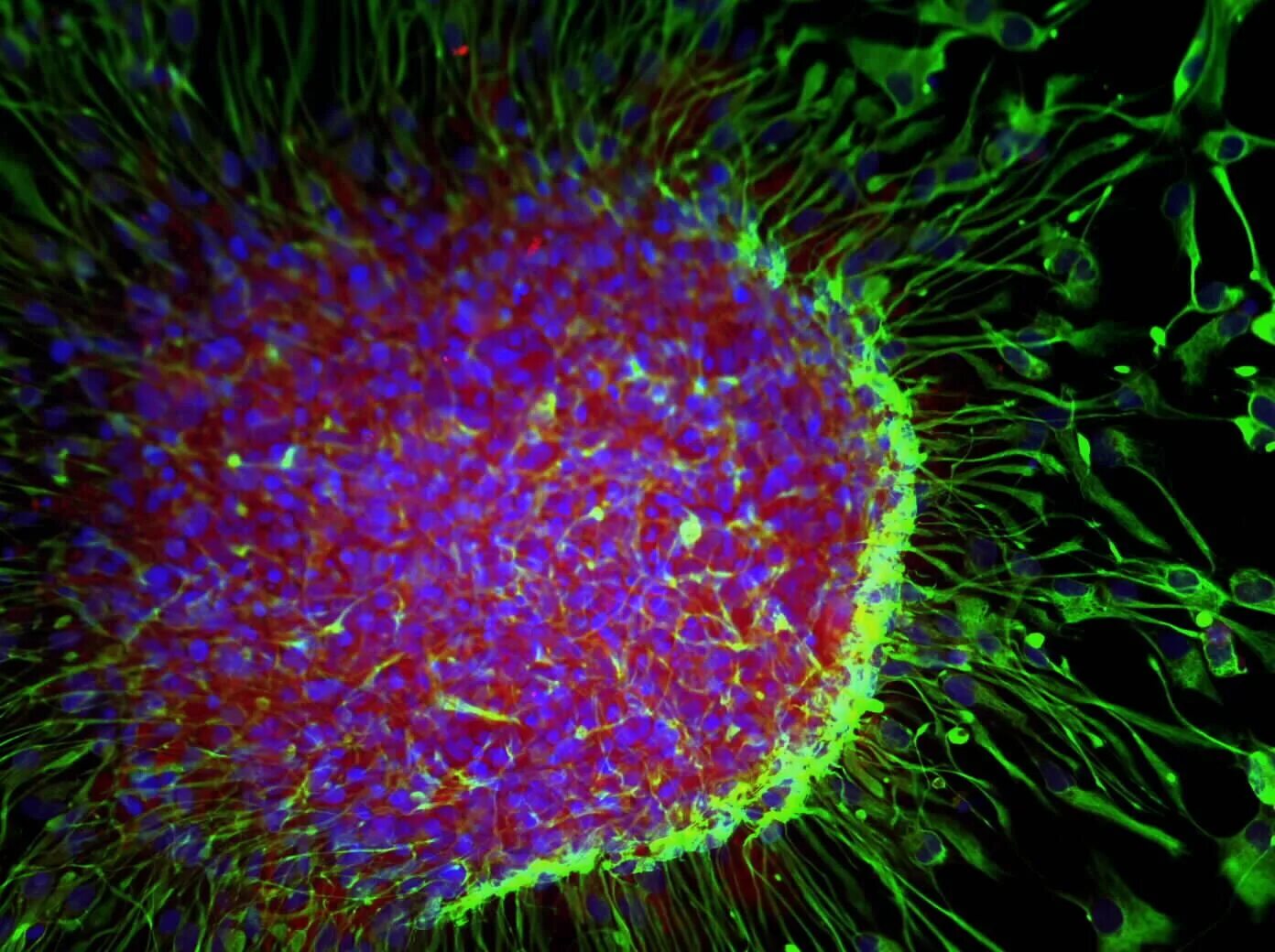 Размер вируса и клетки. Бактериофаг под микроскопом. Вирус иммунодефицита под микроскопом. Вирусы удалось увидеть лишь с помощью микроскопа. Размеры вирусов и бактерий.