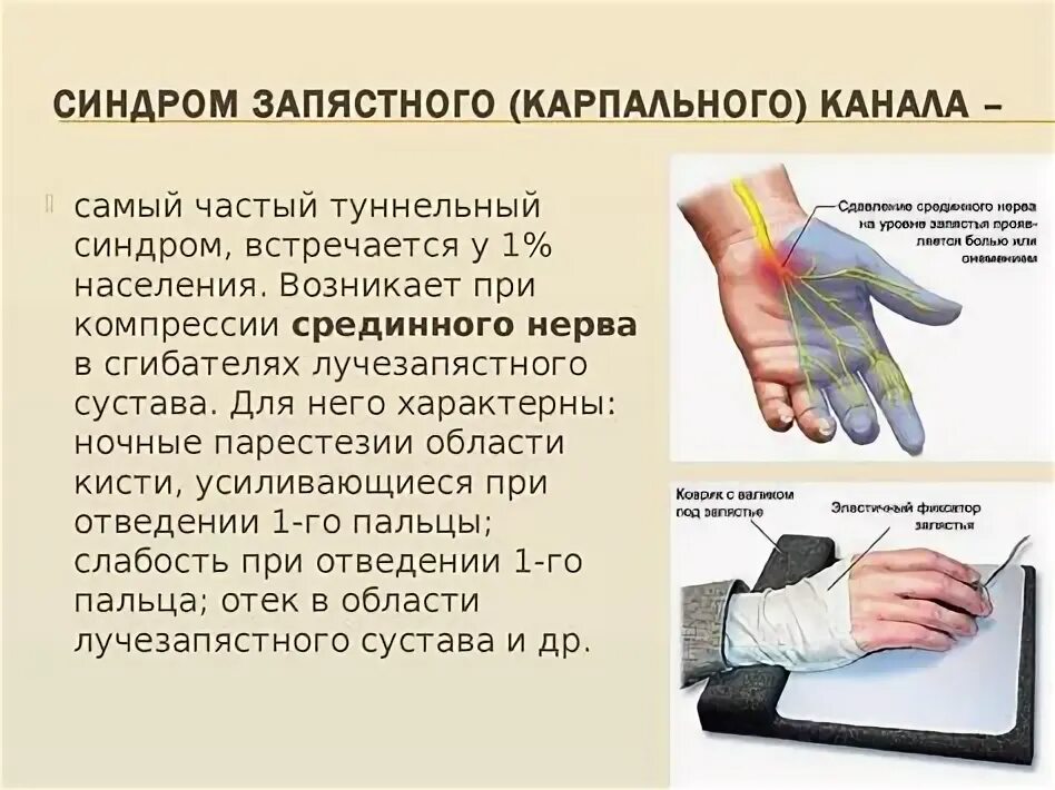 ОНЕМЕЛА ЛЕВАЯ pictures