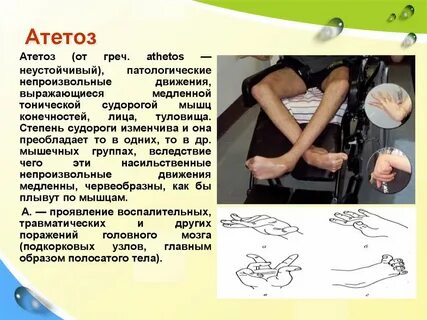 Непроизвольные движения