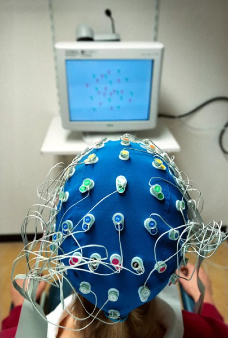 Ээг мозга цена. Электроэнцефалография (ЭЭГ). Электроэнцефалография головного мозга (ЭЭГ). Что такое ЭЭГ В медицине. РЭГ И ЭЭГ.