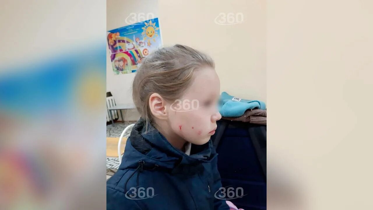 Человек убился об стену. Девушка головой об стену. Избил головой об стену. Биться головой об стену. Девушка головой об стену.