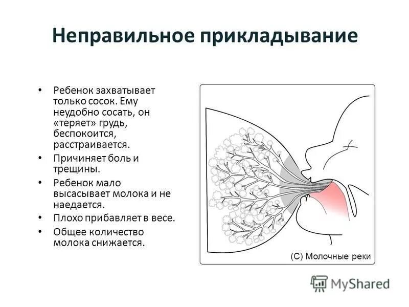 Грудное вскармливание схема. Неправильное прикладывание ребенка к груди. Неправильно захват груди. Признаки неправильного прикладывания ребенка.