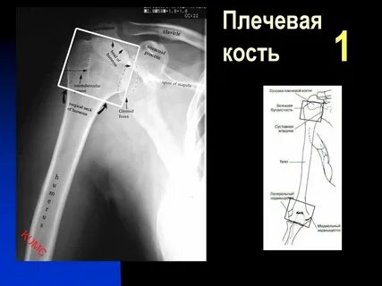 Проксимальный конец плечевой