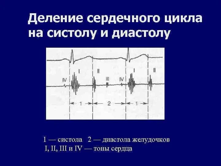 Тоны сердечного цикла. Механокардиограмма диастола. систола диастола тоны сердца. диастола сердца на экг. экг физиология систола и диастола.