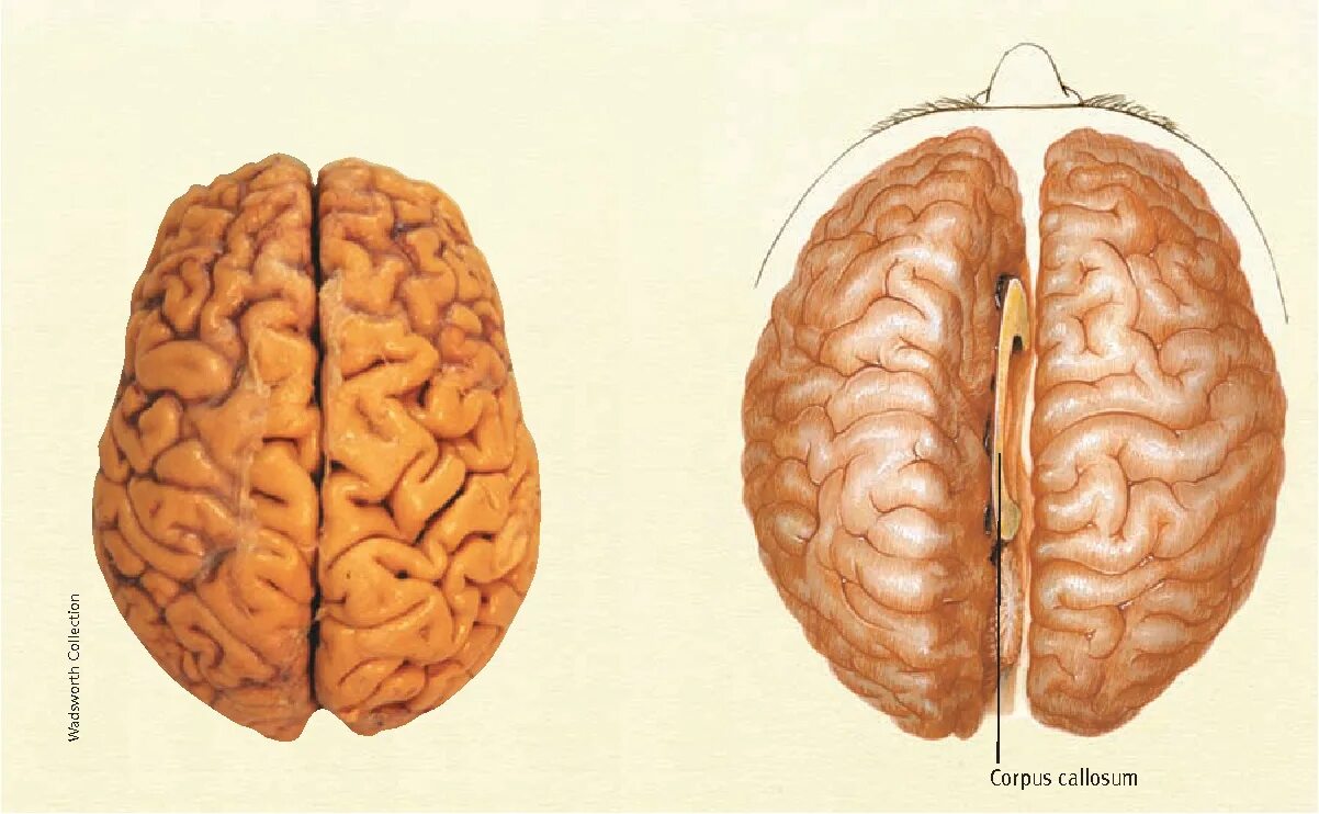 Полушария соединяет между собой. Corpus callosum строение. Полушария головного мозга мозолистое. Полушария и мозолистое тело. Правое и левое полушарие мозолистое тело.