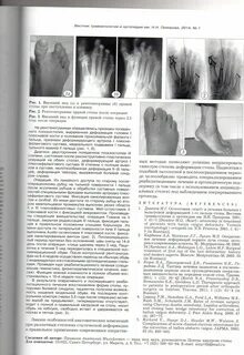 Вестник травматологии