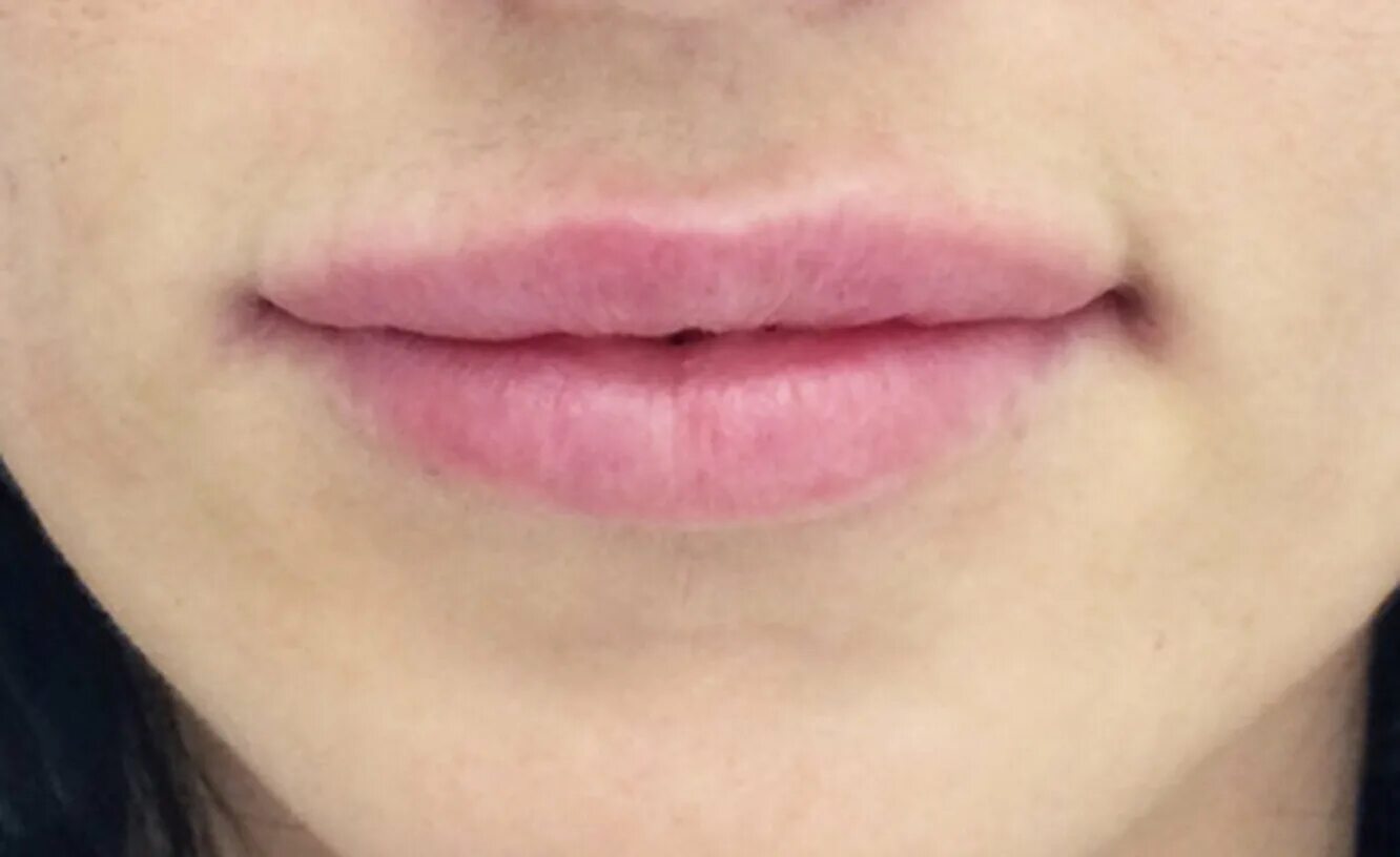 Свисающие губы пельмешки. Губы пельмени. Губы пельмени. Губы пельмени. Свисающие губы пельмешки.