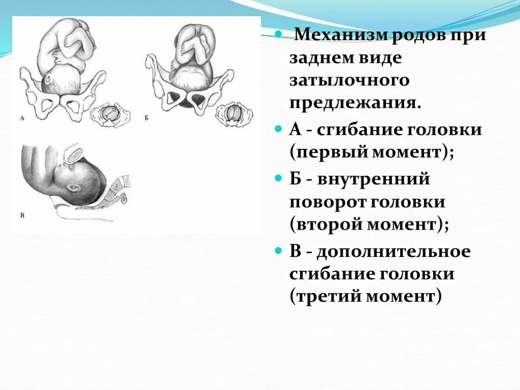 Самопроизвольное предлежание. Задний вид затылочного предлежания биомеханизм родов. Механизм родов при затылочном предлежании плода. Механизм родов при заднем затылочном предлежании. Передний вид затылочного предлежания биомеханизм родов.