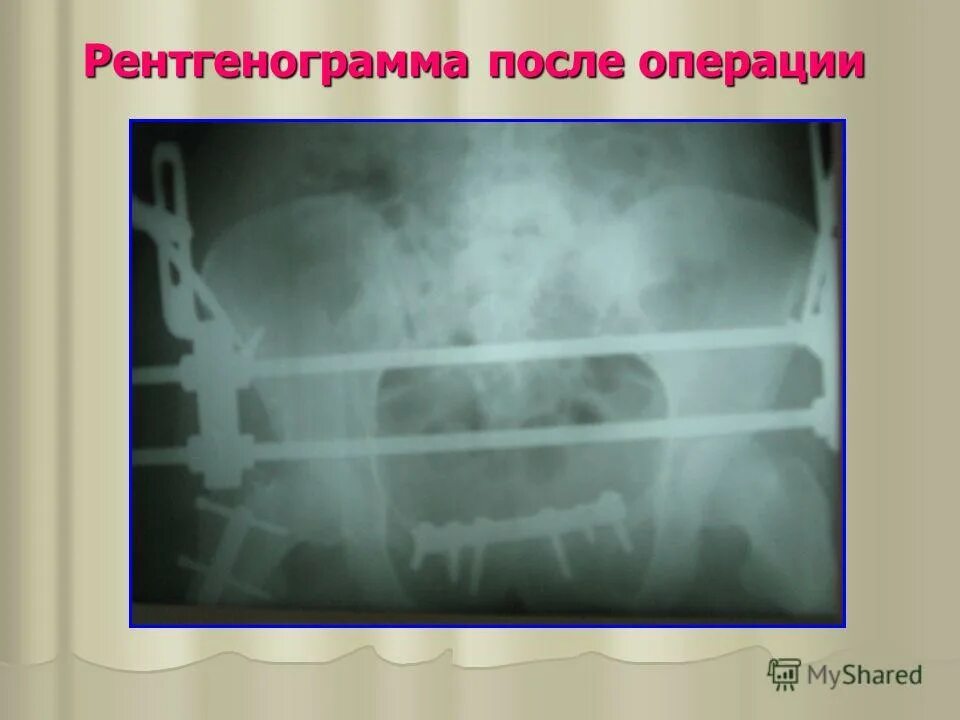 диагноз сочетанная травма