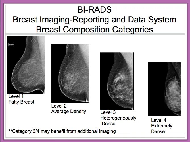 Кисты bi rads 2. Классификация молочной железы bi rads. Birads 2 молочной железы что это такое. Birads классификация. Bi rads 4 молочной железы.