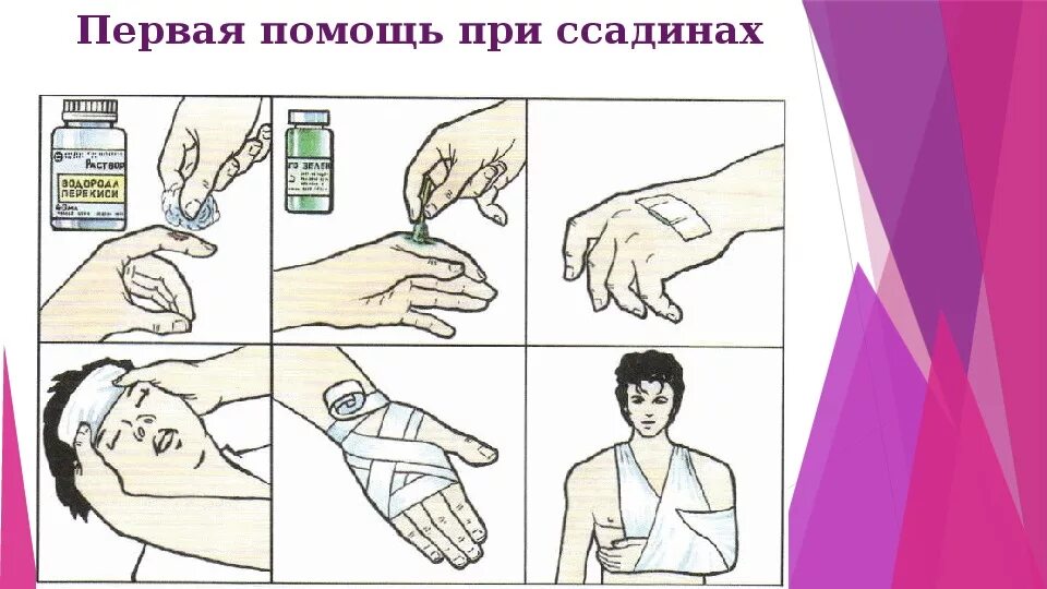 Обработка пореза. Оказание первой помощи при порезах. оказание первой помощи при травмах кожи. оказание первой помощи при царапинах. оказание первой помощи при повреждении кожи.