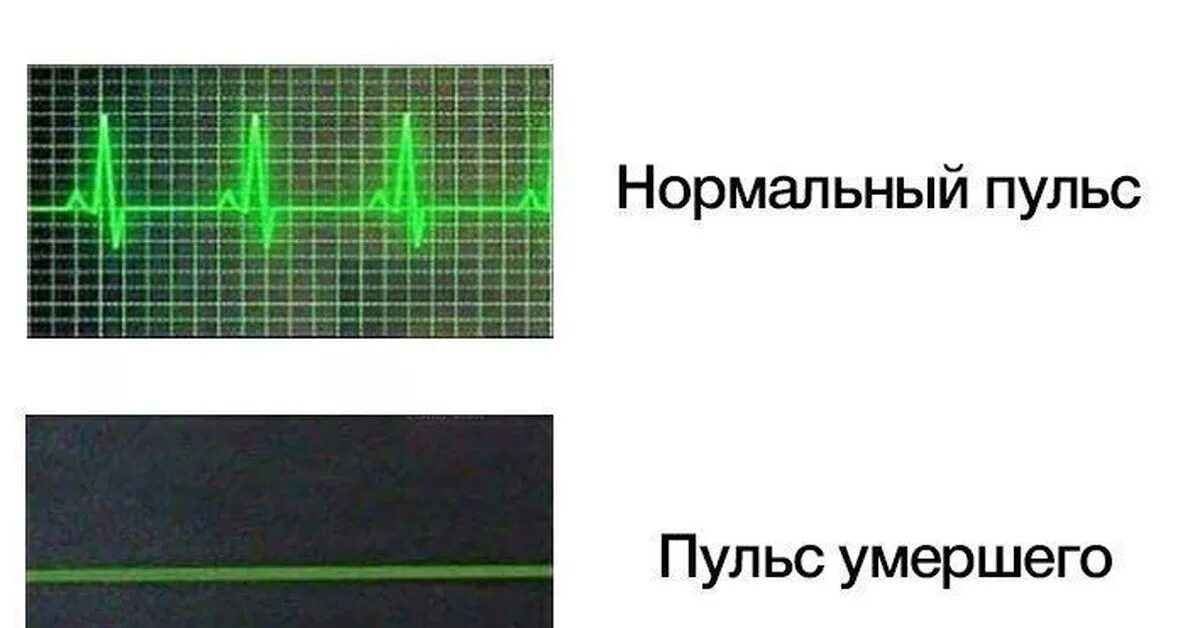 Песня чувства на минимум пульсы минимум. Пульс. Мемы про пульс. Пульс смерти. Шутки про сердцебиение.