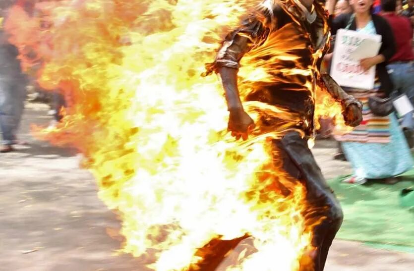 While you burning alive