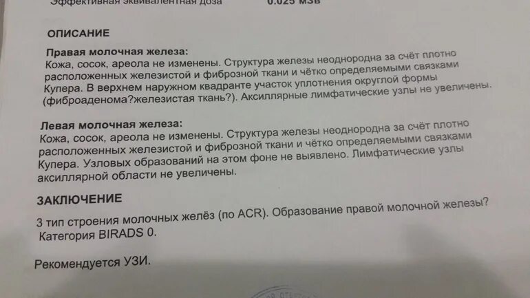 Анализ маммографии. Маммография молочных желез в норме у женщин. Маммография молочной железы норма у женщин. Маммография молочных желез результат норма. Протокол УЗИ импланты молочных.