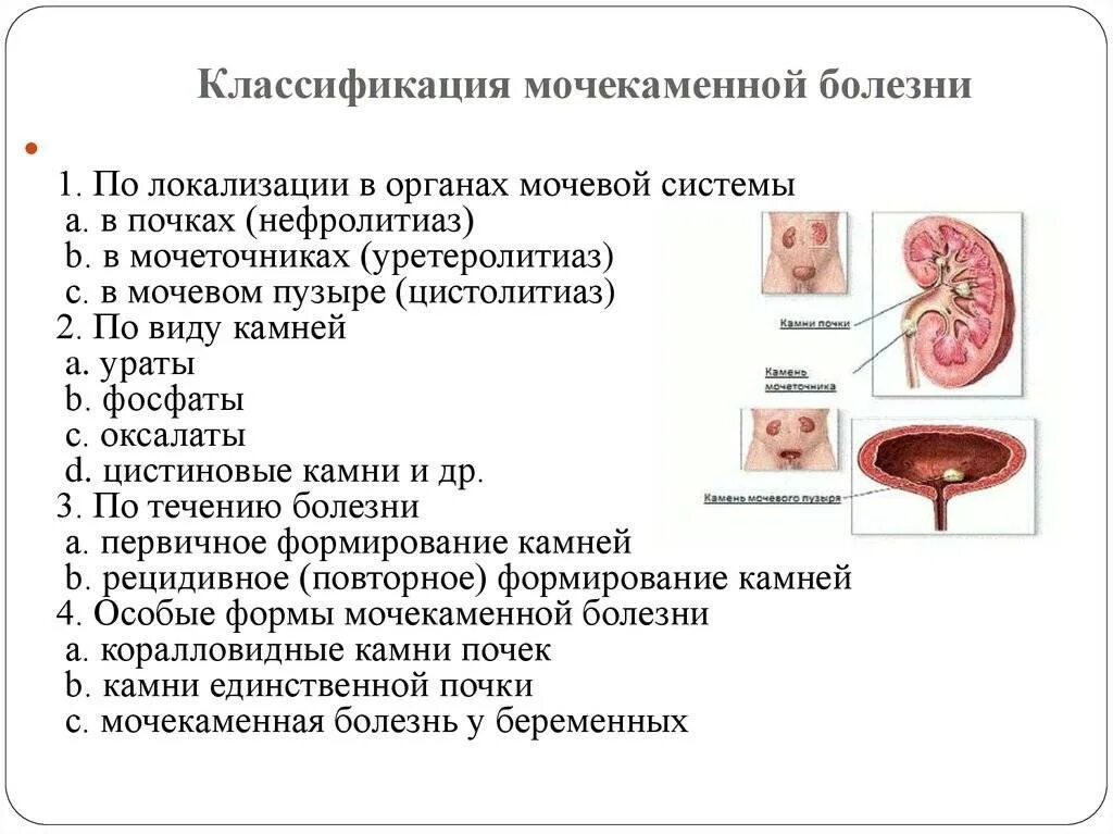 Камни в почках заболевание. Мочекаменная болезнь почек классификация. Размеры камней в почках классификация. Мочекаменная болезнь классификация камней нефролитиаз. Клинические признаки мочекаменной болезни.