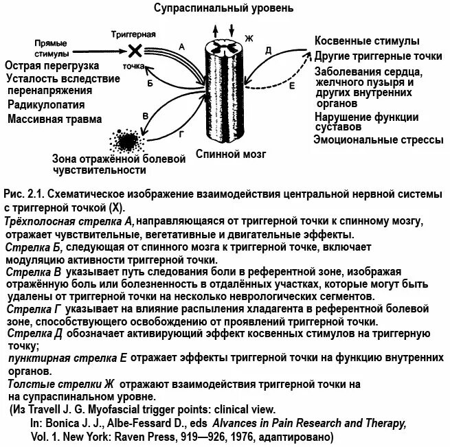 Триггерные точки это простыми словами. Триггерная точка под микроскопом. Триггерная точка патогенез. Активные триггерные пункты характеризуются. Триггерные точки определение.