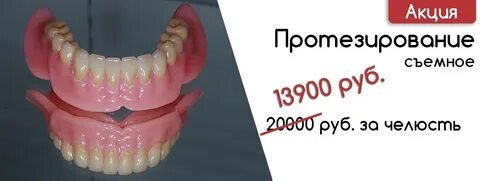 Протезирование в рассрочку