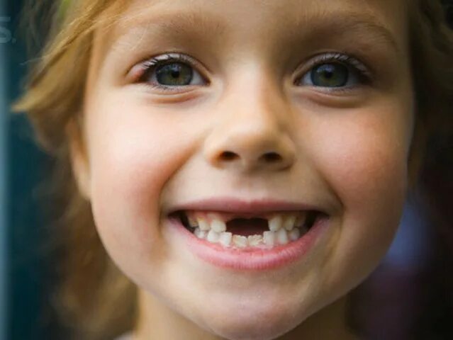 Schoolboy grows two sets of teeth Mirror Online