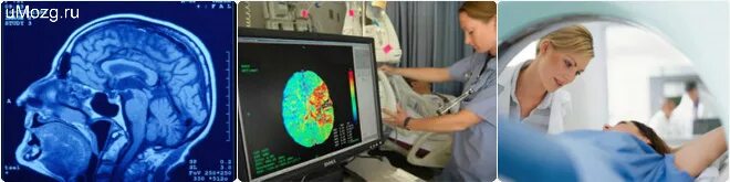 Мрт или УЗИ сосудов головного мозга. Доплерографическое исследование головного мозга. УЗИ головного мозга взрослым.