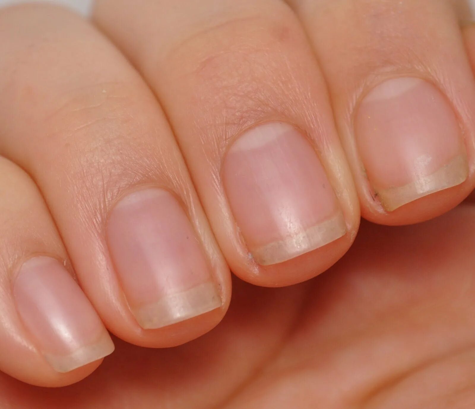 большие лунки на ногтях рук. ногти здорового человека. большие лунки на ногтях рук. большие лунки на ногтях рук. лунки на ногтях.