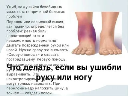 Сколько дней болит ушиб