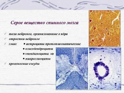 В сером веществе спинного мозга расположены тела