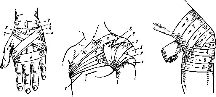 Техника наложения крестообразной повязки