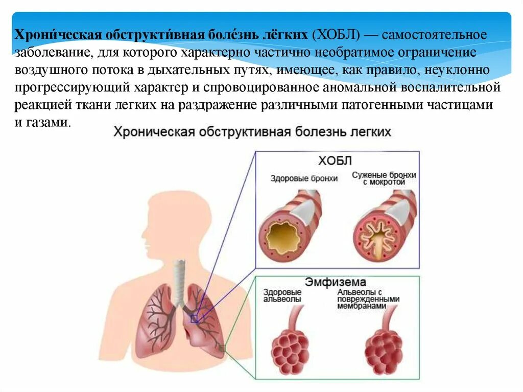 Презентация заболевание легких. Для хронической обструктивной болезни лёгких характерно. Бронхиальная обструкция у ХОБЛ. При хронической обструктивной болезни легких. Бронхиальная обструкция при хоб.