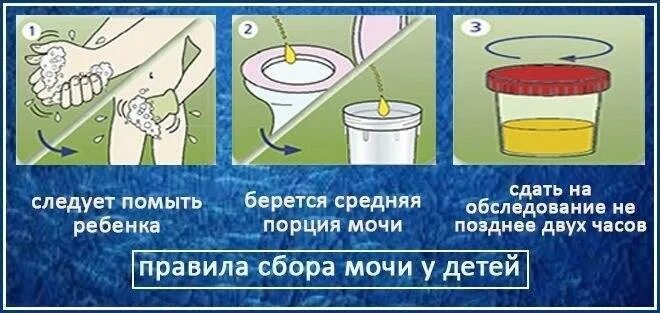 Сбор мочи у детей алгоритм. Сбор мочи по Нечипоренко у детей. Сбор мочи по Нечипоренко у детей алгоритм. Сбор анализа мочи поинечипоренко.