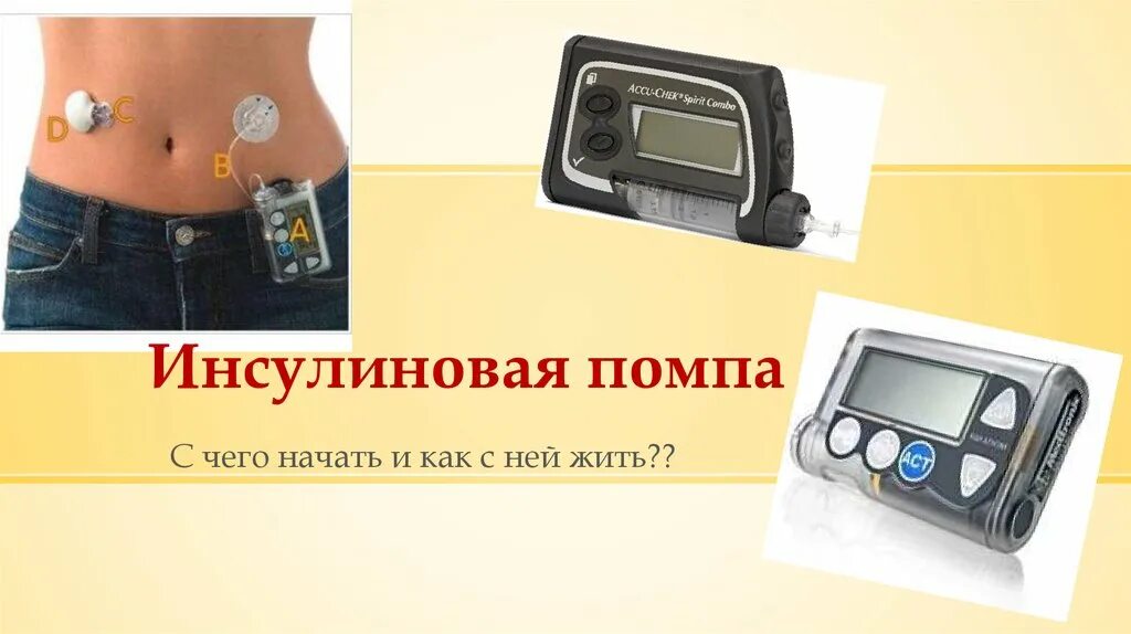 Тип инсулиновой помпы