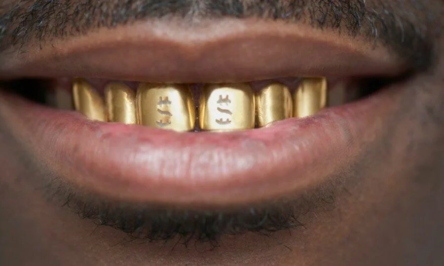 приснились золотые зубы. грилзы опал. грилзы кизару. золото в стоматологии. грилзы кизару.