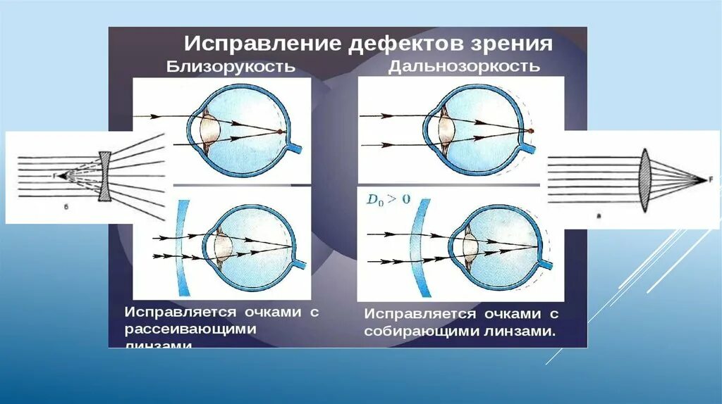 Дефекты зрения ответы. Дефекты зрения и их исправление. Дефекты зрения близорукость. Дефекты зрения близорукость и дальнозоркость. Дефекты зрения и их коррекция.