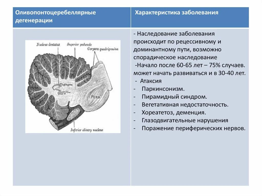 Атрофия головного мозга продолжительность. Понто церебеллярная атрофия. Мозжечковая дегенерация мрт. Оливопонтоцеребеллярная дегенерация симптомы. Оливопонтоцеребеллярная дегенерация мрт.